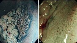 LST  "skirt": что еще мы о них не знали?